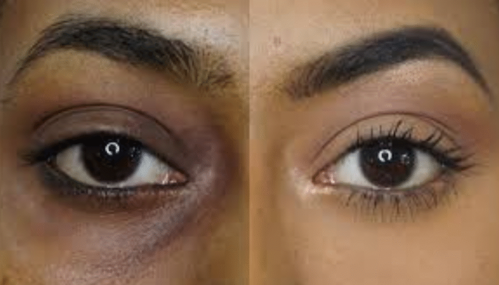 say good bye to dark circle